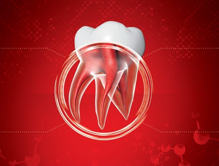 Discover the multiple indications of Biodentine Septodont